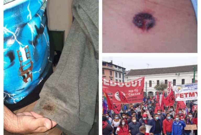 Periodista de Ecuador Chequea recibió un impacto de una bala de goma a quemarropa