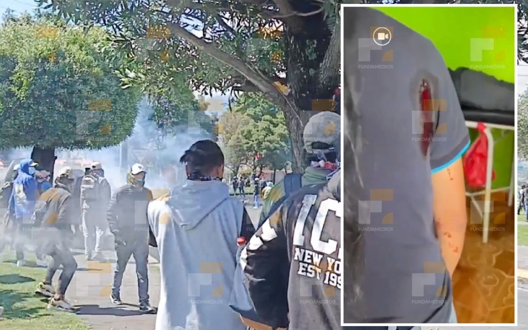 Periodista comunitario recibe impacto de bala mientras cubría el paro nacional 